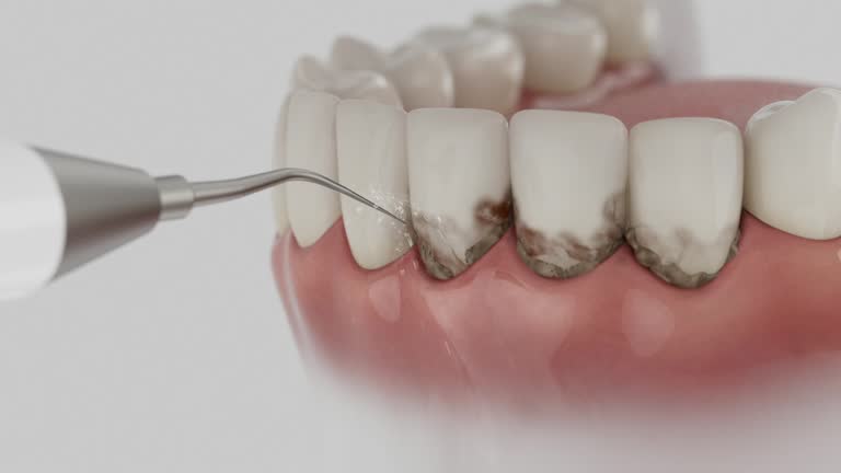 Trusted Teeth Cleaning And Checkup service in Orchard Homes, MT - Dentist Open Now
